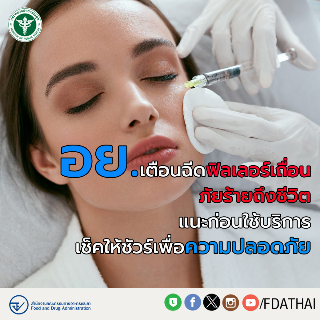 อย. ห่วงใย แนะประชาชนก่อนการฉีดฟิลเลอร์ตรวจสอบผลิตภัณฑ์ให้แน่ชัดว่าผ่านการขึ้นทะเบียน จากอย. หรือไม่