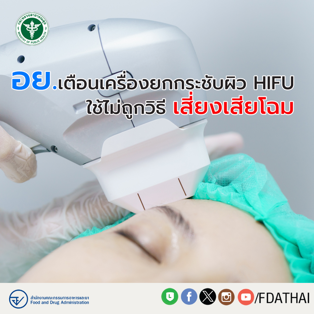 อย. ขอเตือนประชาชนถึงความเสี่ยงจากการใช้เครื่องยกกระชับผิว HIFU