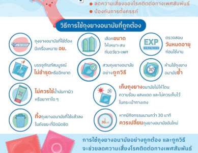วิธีการใช้ถุงยางอนามัยที่ถูกต้อง